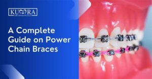 Adjustments: What To Expect With Power Chain Braces