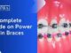 Adjustments: What To Expect With Power Chain Braces