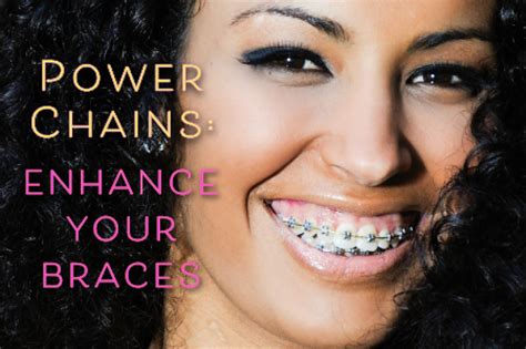 Innovations In Power Chain Braces Technology