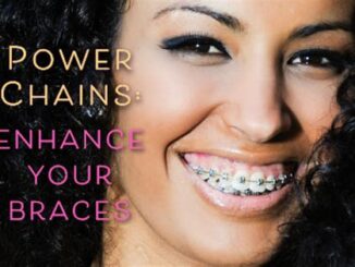 Innovations In Power Chain Braces Technology