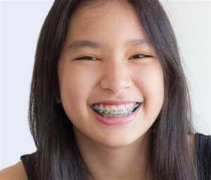 Inspiring Testimonials From Power Chain Brace Wearers