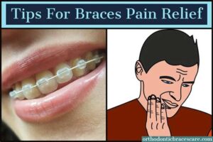 Tips For Managing Discomfort From Power Chain Braces